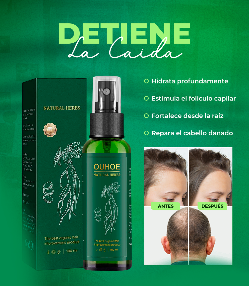 OUHOE - NO MÁS CAÍDA DE CABELLO